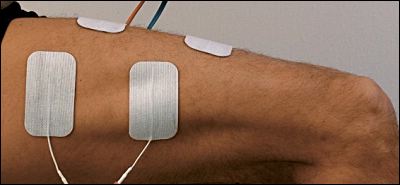 Electrodes<br><br>